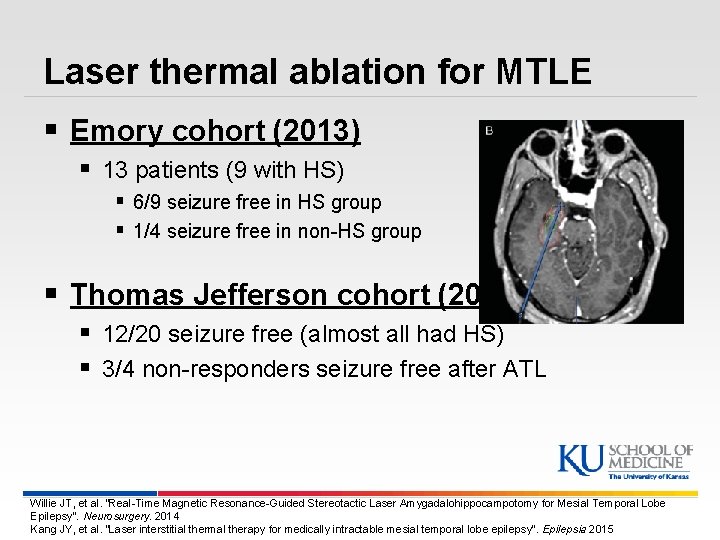 Laser thermal ablation for MTLE § Emory cohort (2013) § 13 patients (9 with