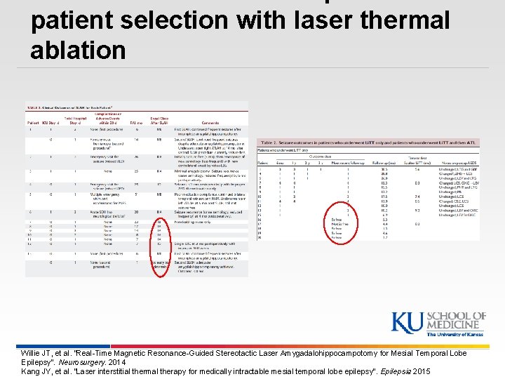 patient selection with laser thermal ablation Willie JT, et al. “Real-Time Magnetic Resonance-Guided Stereotactic