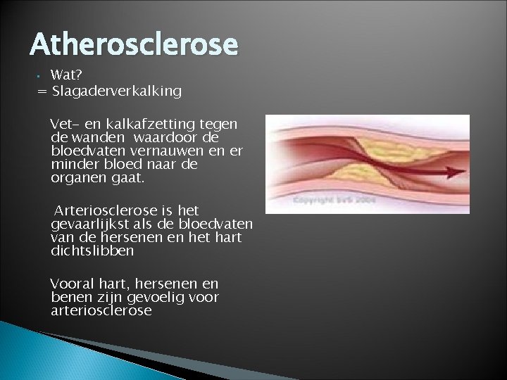 Atherosclerose Wat? = Slagaderverkalking • Vet- en kalkafzetting tegen de wanden waardoor de bloedvaten
