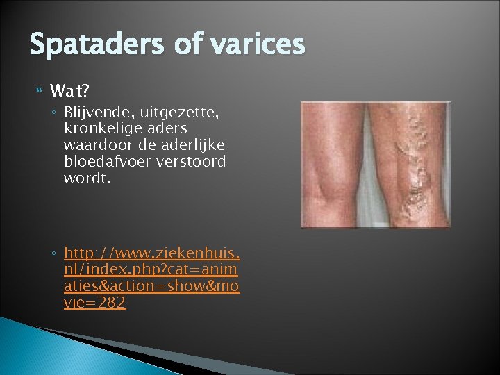 Spataders of varices Wat? ◦ Blijvende, uitgezette, kronkelige aders waardoor de aderlijke bloedafvoer verstoord
