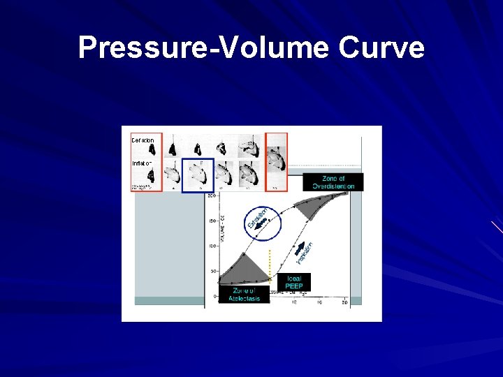 Pressure-Volume Curve 