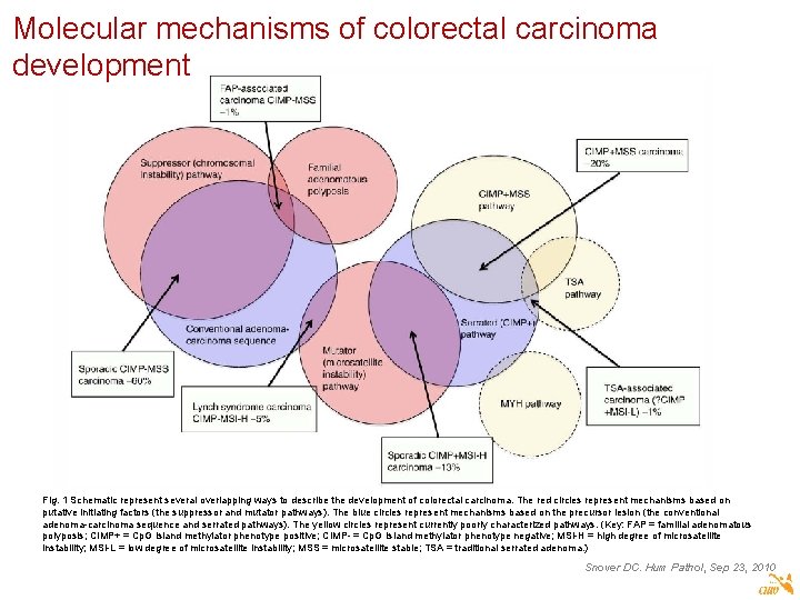 Molecular mechanisms of colorectal carcinoma development Fig. 1 Schematic represent several overlapping ways to