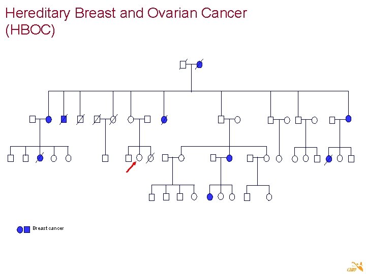 Hereditary Breast and Ovarian Cancer (HBOC) Breast cancer 