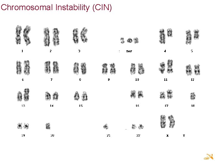 Chromosomal Instability (CIN) 