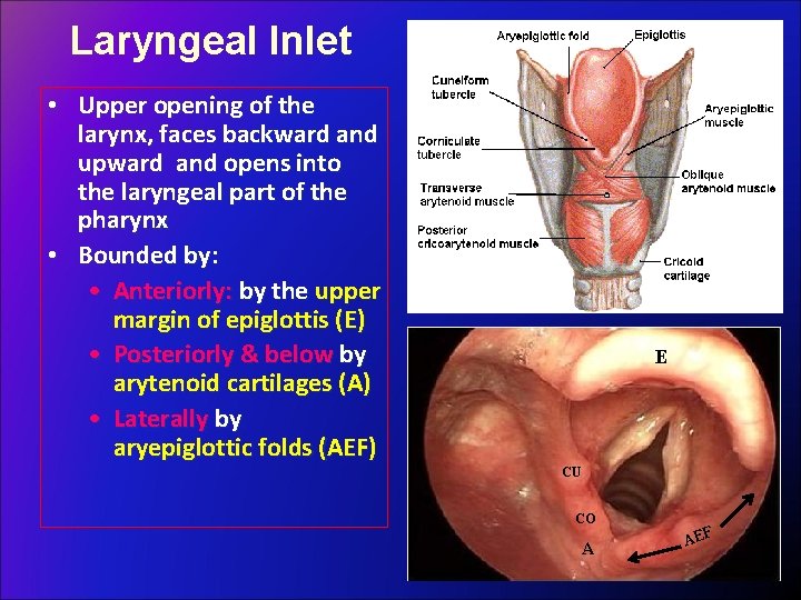 Laryngeal Inlet • Upper opening of the larynx, faces backward and upward and opens