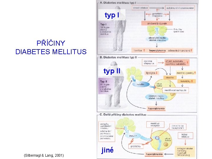 typ I PŘÍČINY DIABETES MELLITUS typ II (Silbernagl & Lang, 2001) jiné 