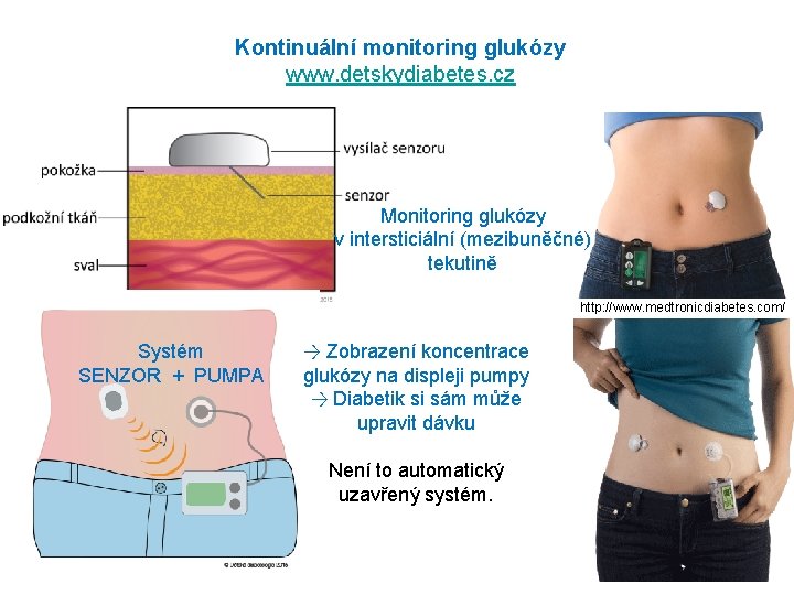 Kontinuální monitoring glukózy www. detskydiabetes. cz Monitoring glukózy v intersticiální (mezibuněčné) tekutině http: //www.