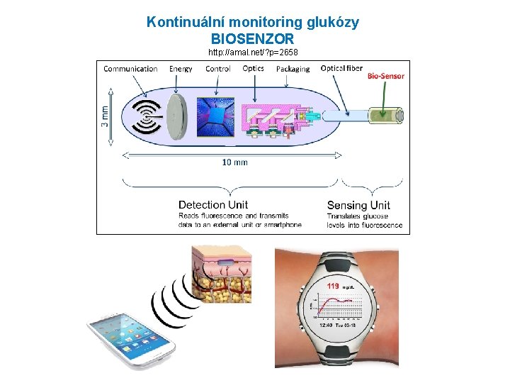 Kontinuální monitoring glukózy BIOSENZOR http: //amal. net/? p=2658 