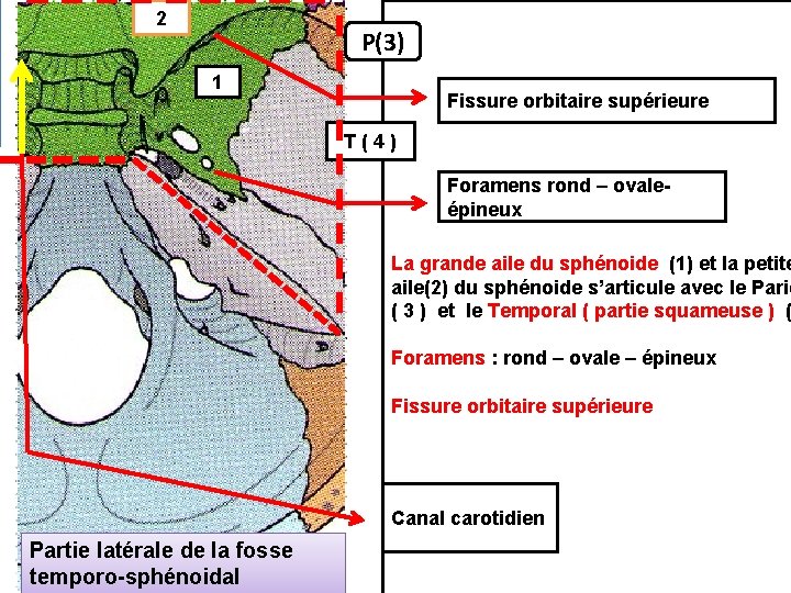 2 P(3) 1 Fissure orbitaire supérieure T ( 4 ) Foramens rond – ovaleépineux