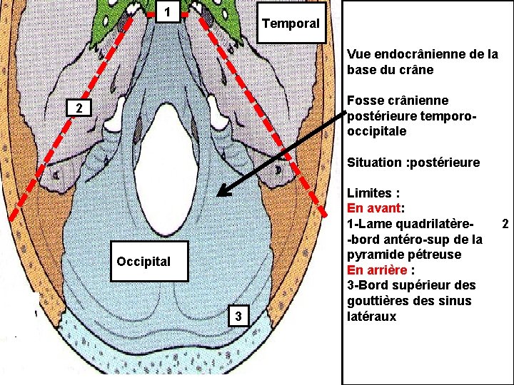 1 Temporal Vue endocrânienne de la base du crâne Fosse crânienne postérieure temporooccipitale 2
