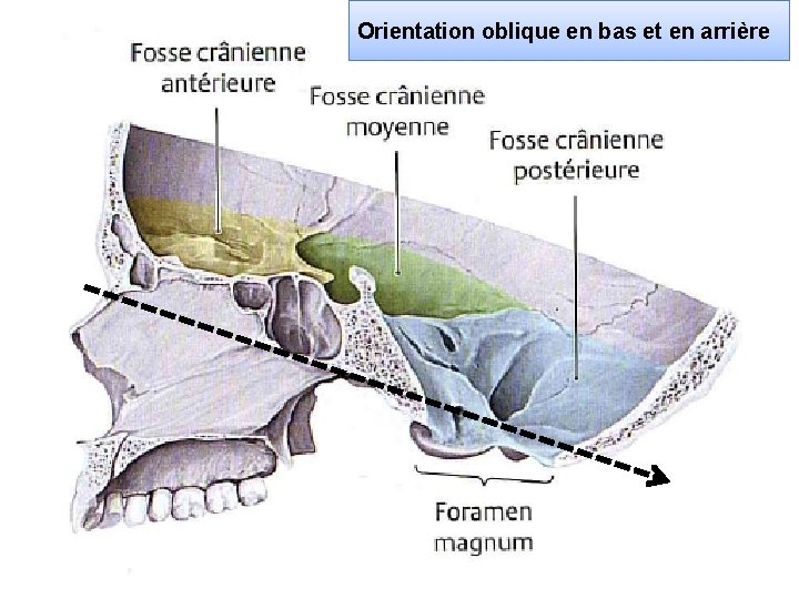 Orientation oblique en bas et en arrière 