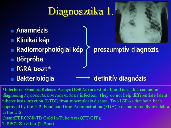 Diagnosztika 1. Anamnézis Klinikai kép Radiomorphológiai kép Bőrpróba IGRA teszt* Bakteriológia preszumptív diagnózis definitív