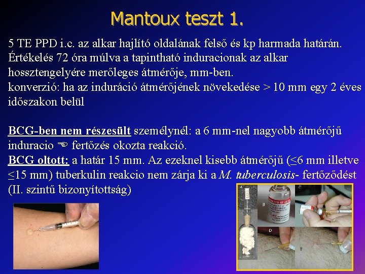 Mantoux teszt 1. 5 TE PPD i. c. az alkar hajlító oldalának felső és