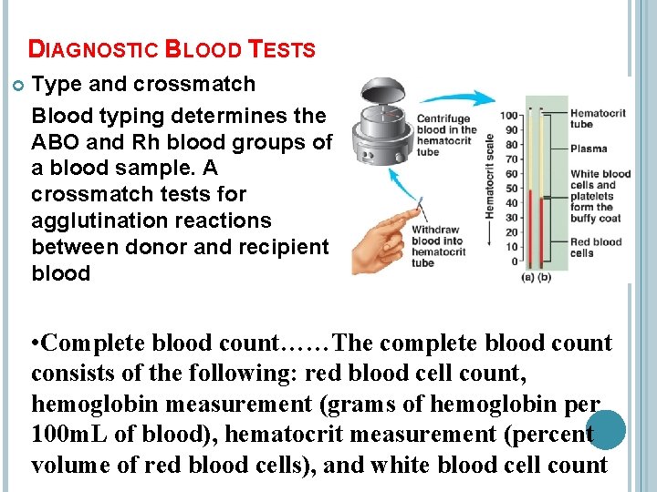 DIAGNOSTIC BLOOD TESTS Type and crossmatch Blood typing determines the ABO and Rh blood