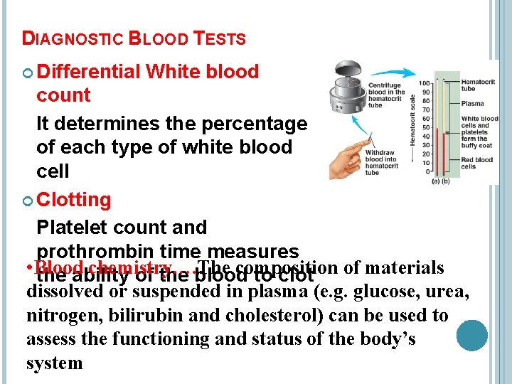 DIAGNOSTIC BLOOD TESTS Differential White blood count It determines the percentage of each type