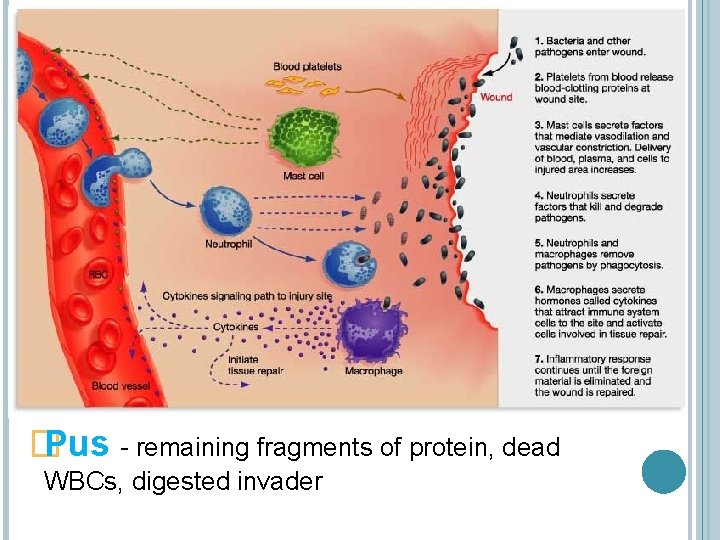 � Pus - remaining fragments of protein, dead WBCs, digested invader 