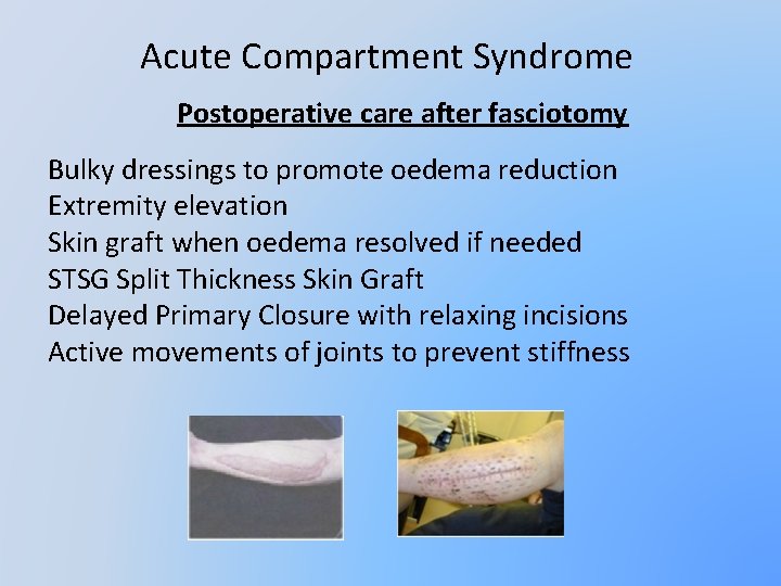 Acute Compartment Syndrome Postoperative care after fasciotomy Bulky dressings to promote oedema reduction Extremity