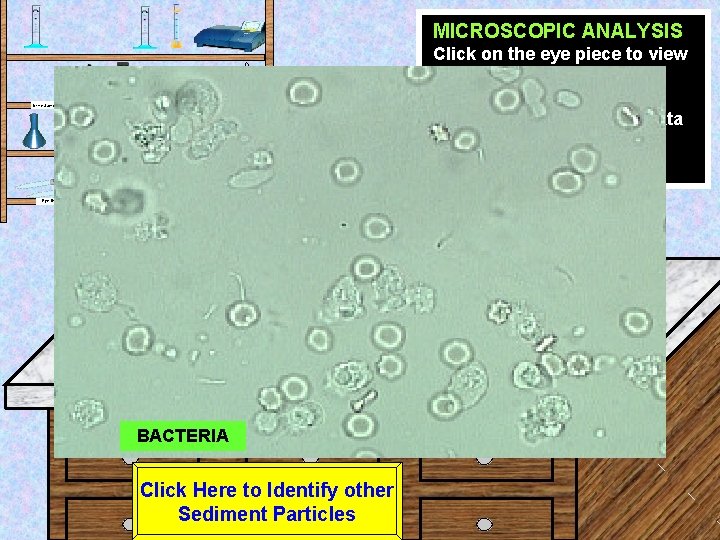 MICROSCOPIC ANALYSIS Click on the eye piece to view the sample at High power.