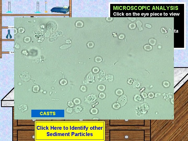 MICROSCOPIC ANALYSIS Click on the eye piece to view the sample at High power.