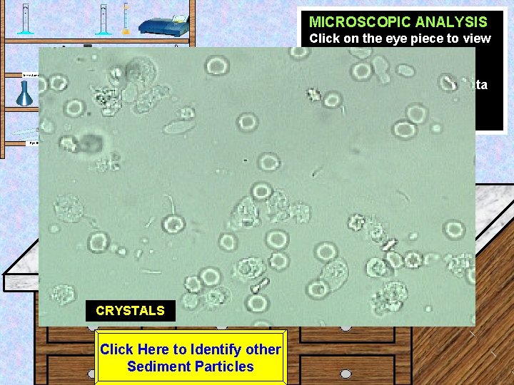 MICROSCOPIC ANALYSIS Click on the eye piece to view the sample at High power.