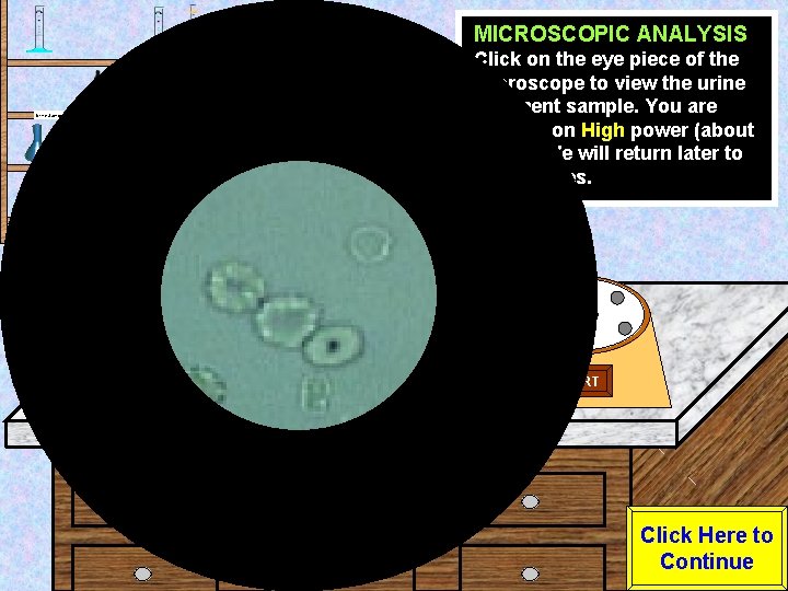 MICROSCOPIC ANALYSIS Urine Sample Test Tube Rack Eye Dropper Click on the eye piece