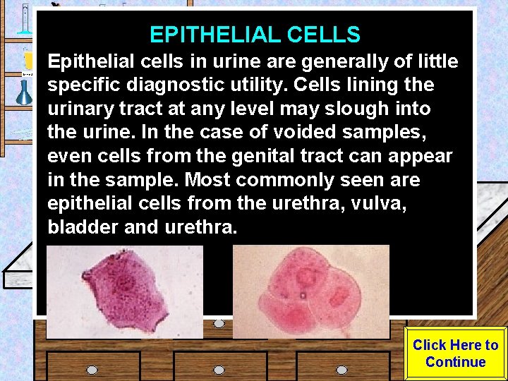 EPITHELIAL CELLS Urine Sample Epithelial cells in urine are generally of little specific diagnostic