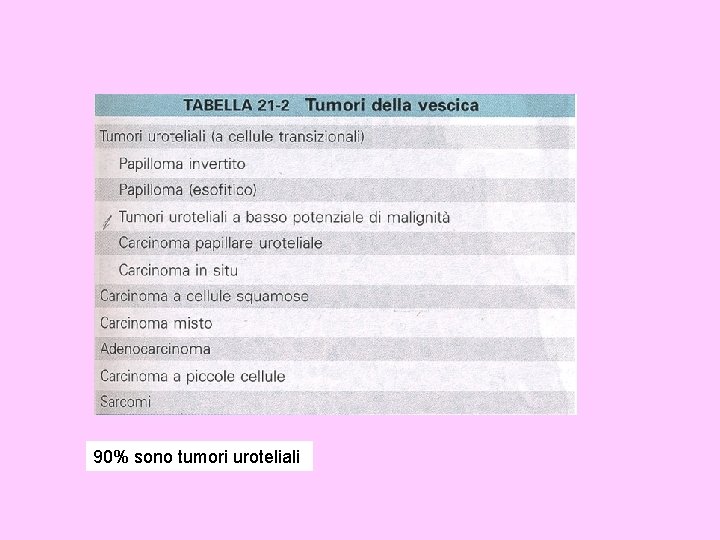 90% sono tumori uroteliali 