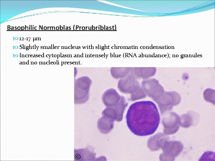 Basophilic Normoblas (Prorubriblast) 12 -17 µm Slightly smaller nucleus with slight chromatin condensation Increased