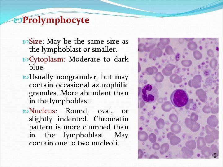  Prolymphocyte Size: May be the same size as the lymphoblast or smaller. Cytoplasm: