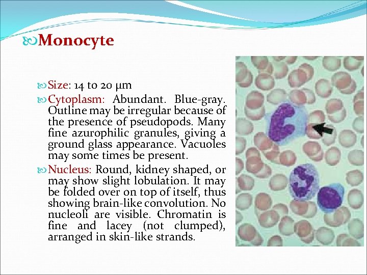  Monocyte Size: 14 to 20 µm Cytoplasm: Abundant. Blue-gray. Outline may be irregular