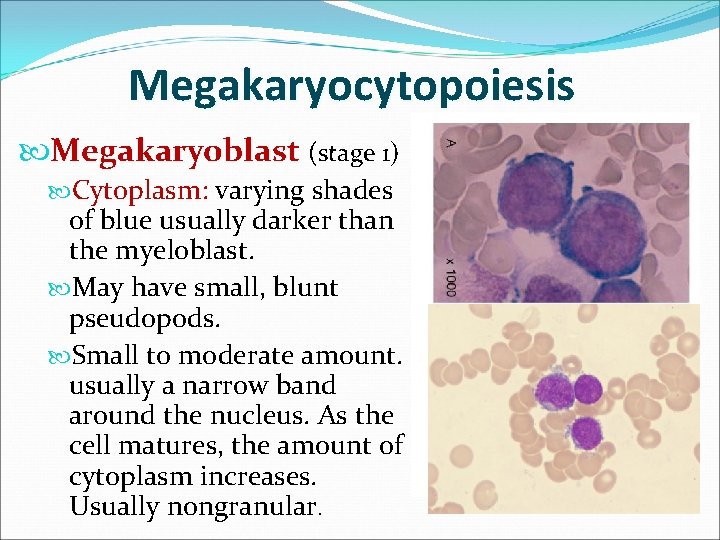 Megakaryocytopoiesis Megakaryoblast (stage 1) Cytoplasm: varying shades of blue usually darker than the myeloblast.