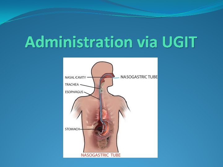 Administration via UGIT 