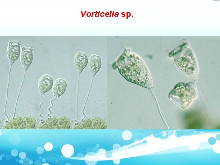 Vorticella sp. 