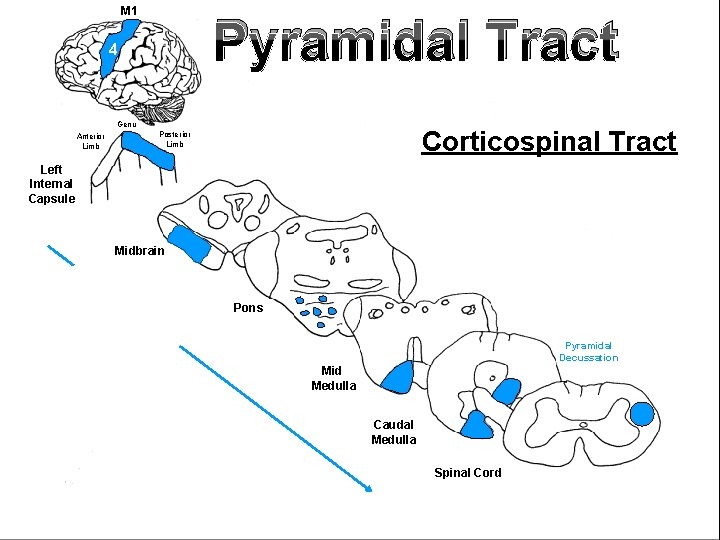 M 1 Pyramidal Tract 4 Genu Anterior Limb Corticospinal Tract Posterior Limb Left Internal