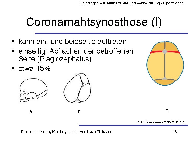 Grundlagen – Krankheitsbild und –entwicklung - Operationen Coronarnahtsynosthose (I) § kann ein- und beidseitig