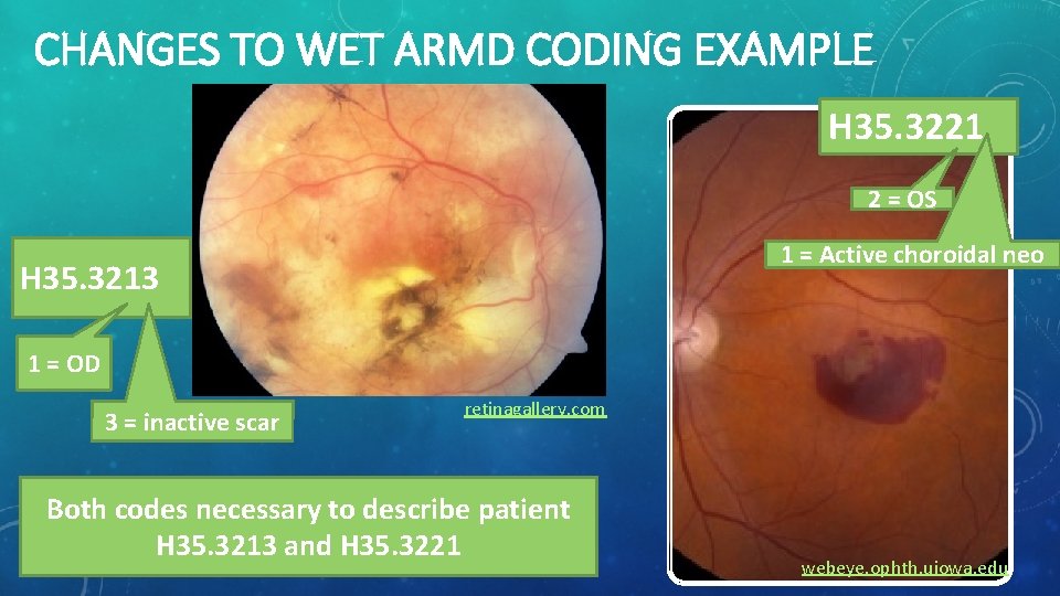 CHANGES TO WET ARMD CODING EXAMPLE H 35. 3221 2 = OS 1 =