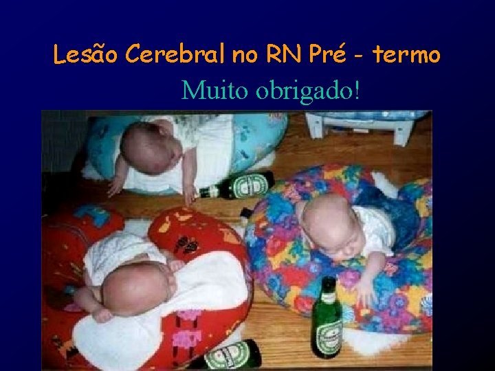 Lesão Cerebral no RN Pré - termo Muito obrigado! 