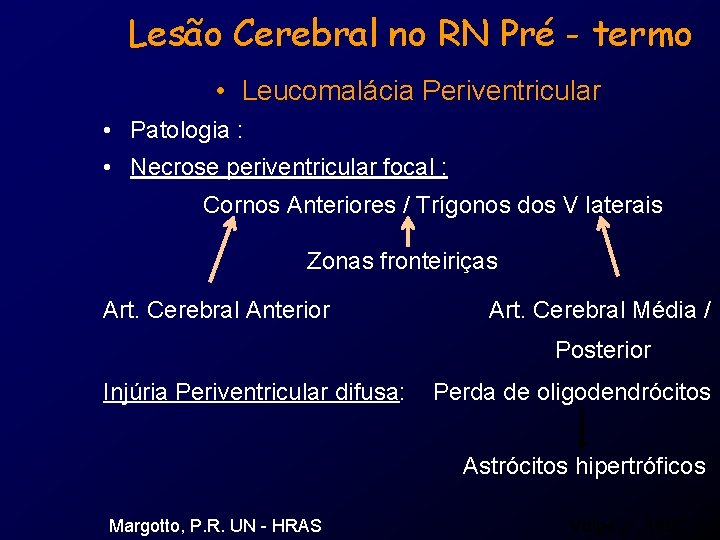 Lesão Cerebral no RN Pré - termo • Leucomalácia Periventricular • Patologia : •