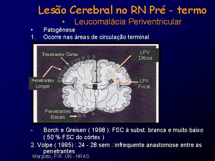 Lesão Cerebral no RN Pré - termo • • 1. Leucomalácia Periventricular Patogênese Ocorre