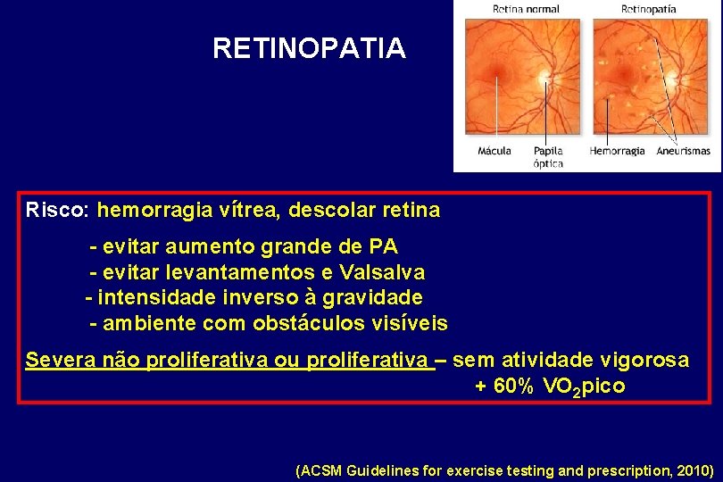 RETINOPATIA Risco: hemorragia vítrea, descolar retina - evitar aumento grande de PA - evitar