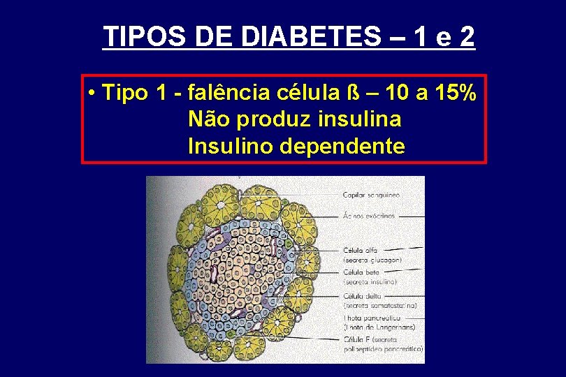 TIPOS DE DIABETES – 1 e 2 • Tipo 1 - falência célula ß