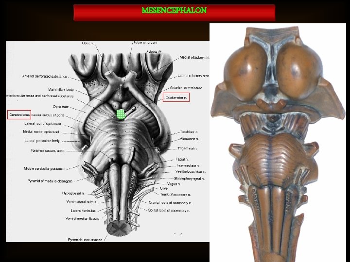 MESENCEPHALON 