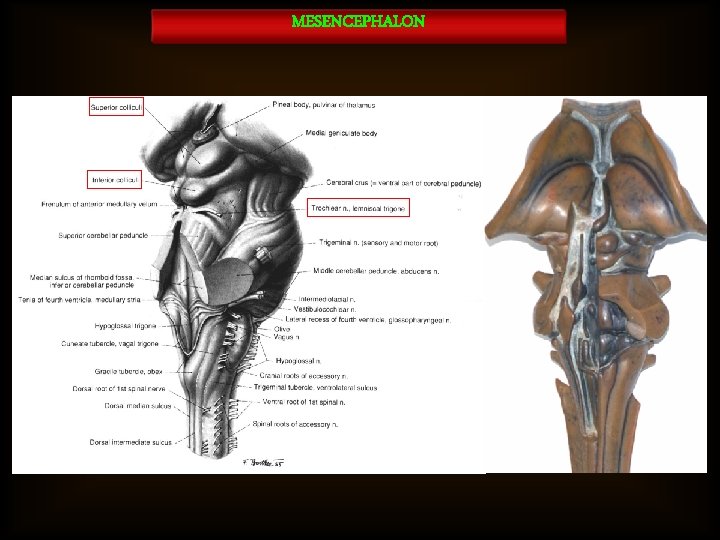 MESENCEPHALON 