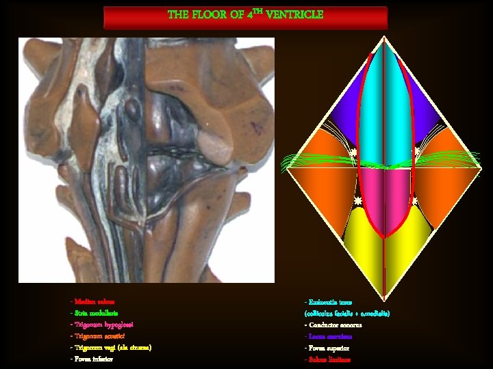 THE FLOOR OF 4 TH VENTRICLE - Median sulcus - Stria medullaris - Trigonum