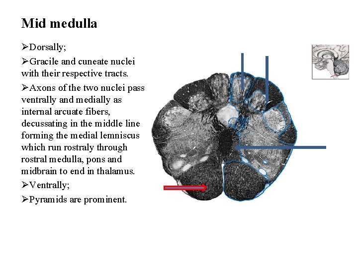 Mid medulla ØDorsally; ØGracile and cuneate nuclei with their respective tracts. ØAxons of the