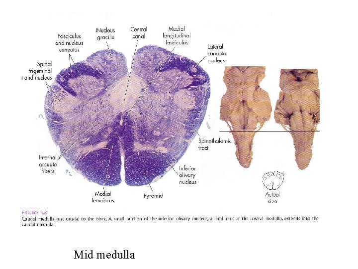 Mid medulla 