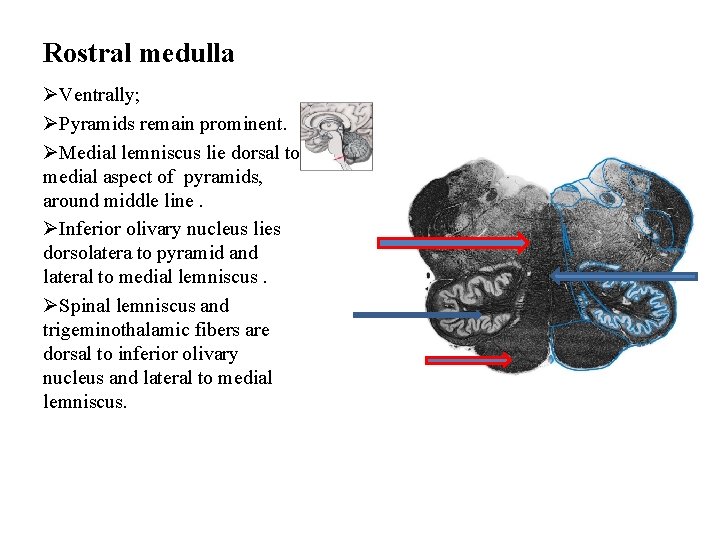 Rostral medulla ØVentrally; ØPyramids remain prominent. ØMedial lemniscus lie dorsal to medial aspect of