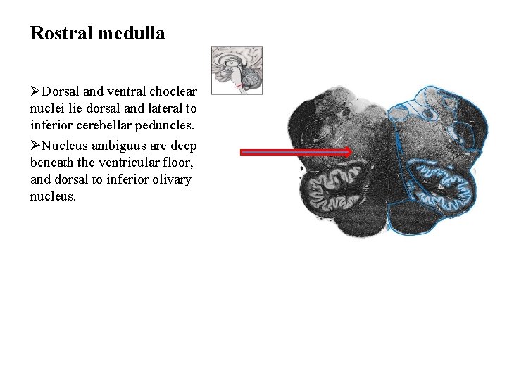 Rostral medulla ØDorsal and ventral choclear nuclei lie dorsal and lateral to inferior cerebellar