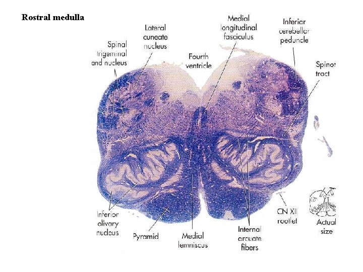 Rostral medulla 