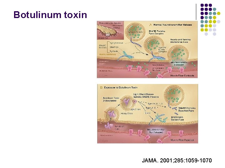 Botulinum toxin JAMA. 2001; 285: 1059 -1070 